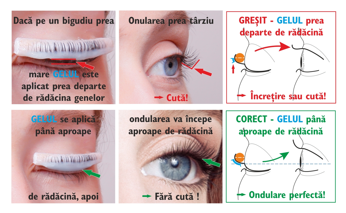 Lifting de gene CLASSIC Aplicarea gelului bigudiuliror foarte mari